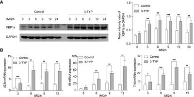 SIRT3 alleviates imiquimod-induced psoriatic dermatitis through deacetylation of XBP1s and modulation of TLR7/8 inducing IL-23 production in macrophages